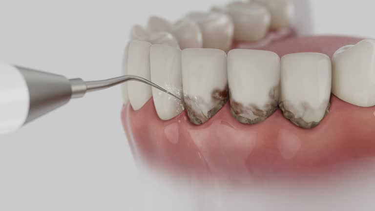 Trusted Teeth Cleaning And Checkup service in Waymart, PA - Dentist Open Now
